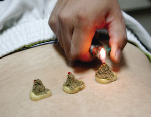 點(diǎn)擊將在新窗口查看全圖 艾灸養(yǎng)生術(shù)語