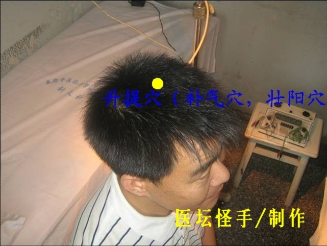 點擊將在新窗口查看全圖 王文遠平衡針灸穴位圖 - 3396815 - 3396815博愛