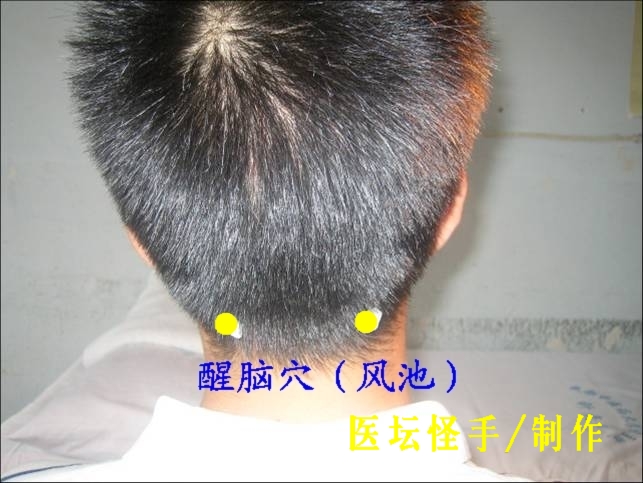 點擊將在新窗口查看全圖 王文遠平衡針灸穴位圖 - 3396815 - 3396815博愛