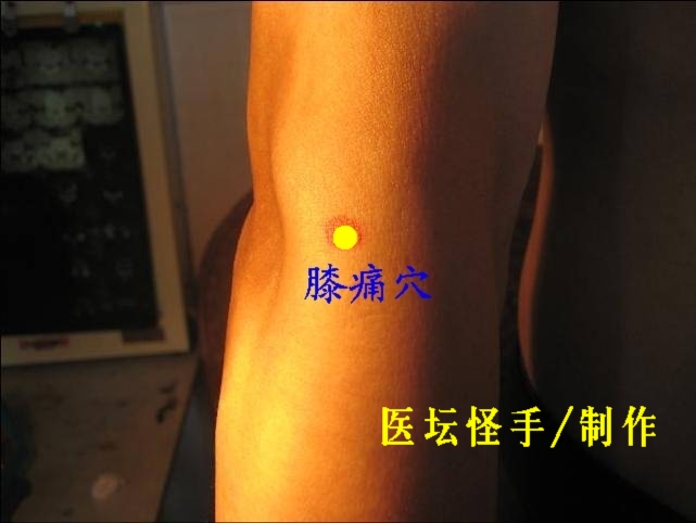 點擊將在新窗口查看全圖 王文遠平衡針灸穴位圖 - 3396815 - 3396815博愛