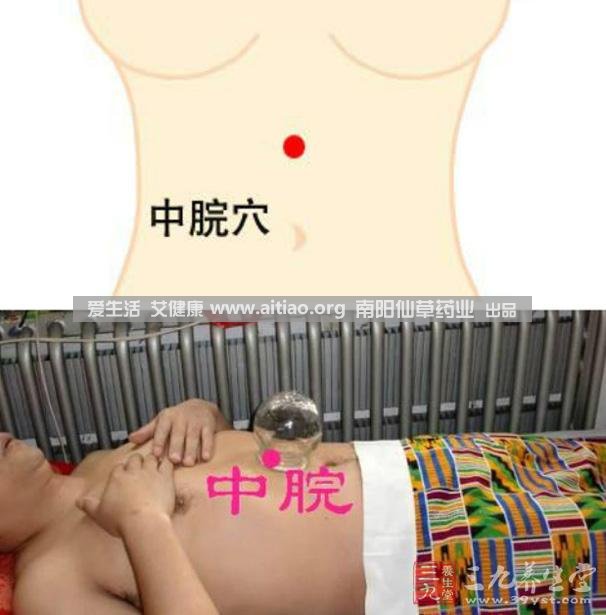 中脘穴位于腹部正中線，臍上4寸的位置上。每天艾灸10-15分鐘，能有效緩解胃部不適的癥狀，同時有助于祛濕。