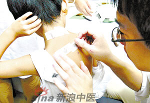 灸法的種類  你知道多少？