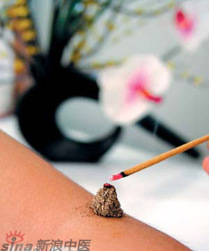 節(jié)氣灸” 冬至，你灸了嗎？
